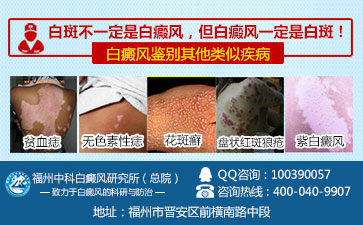 白癜风出现的病因