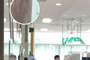 308光疗仪一次照几秒