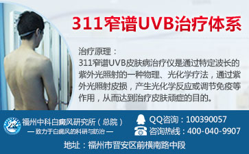 白癜风如何才能