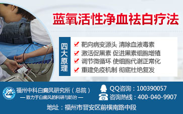 儿童身上的白癜风怎么治