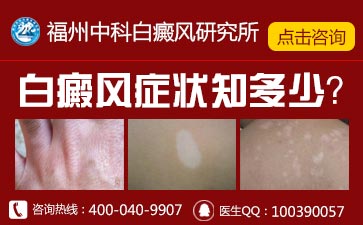 男性皮肤上的白斑如何治疗