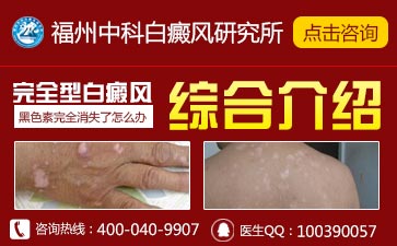 青少年白癜风怎么治疗