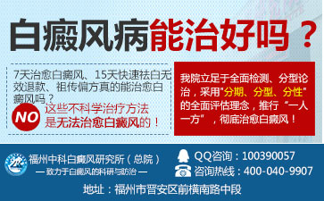 手部患白癜风如何治疗