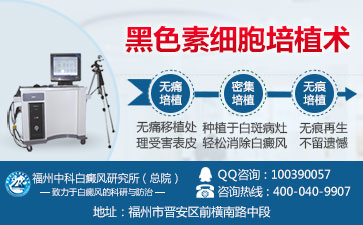 胸部长了白癜风该怎么治疗